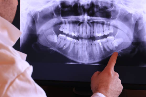 Best Dentist Open Late Near Me  in Lexington, WA