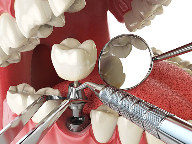 Best Dentist Open Late Near Me  in Lexington, WA